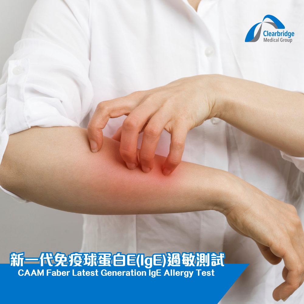 CAAM Faber - 最新一代 IgE 過敏測試