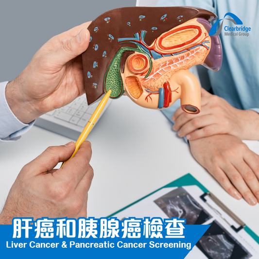 肝癌和胰腺癌檢查