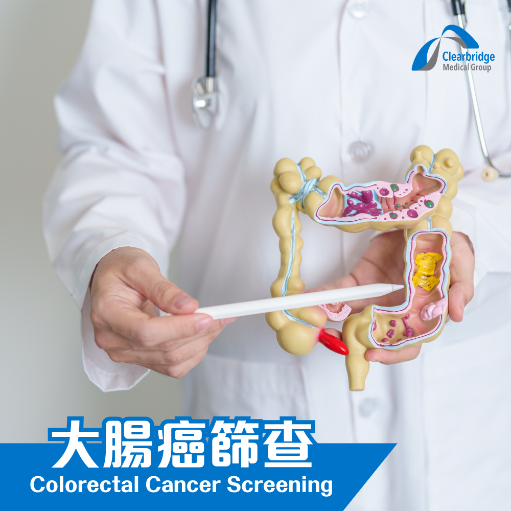 Colorectal Cancer Screening