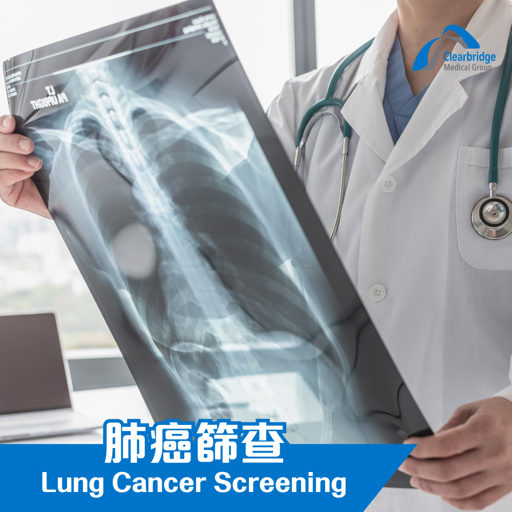 Lung Cancer Screening