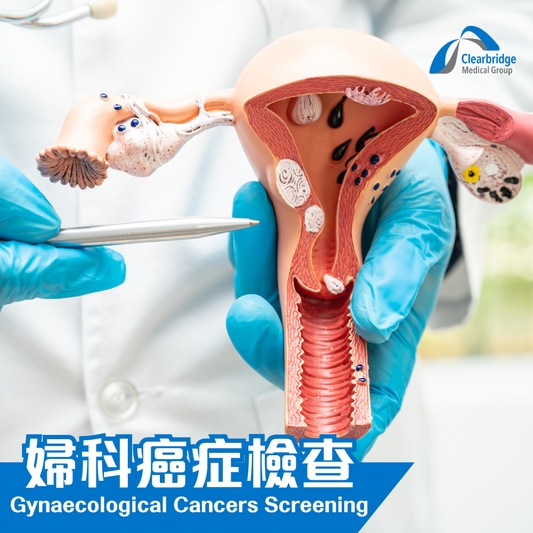 婦科癌症檢查
