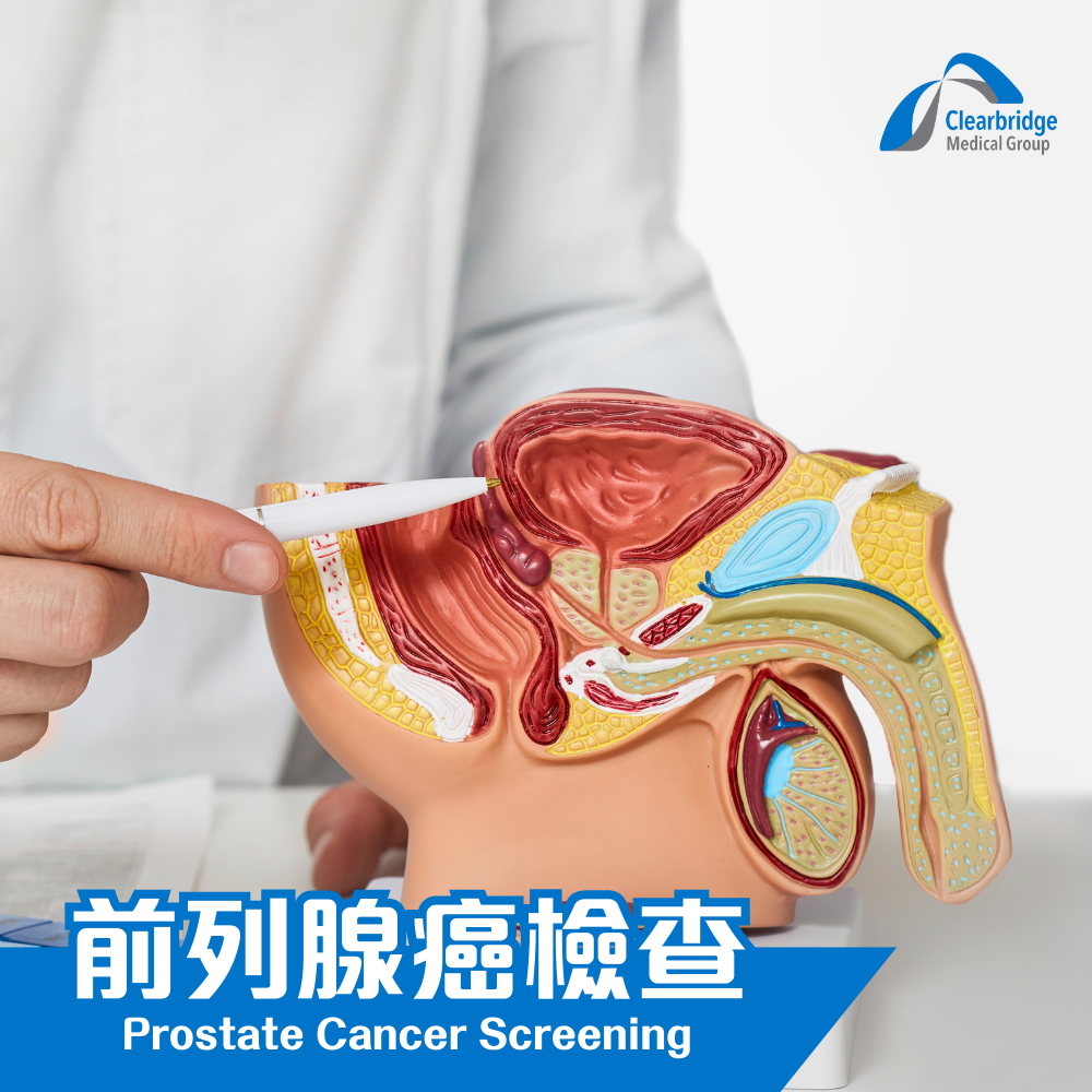 Prostate Cancer Screening