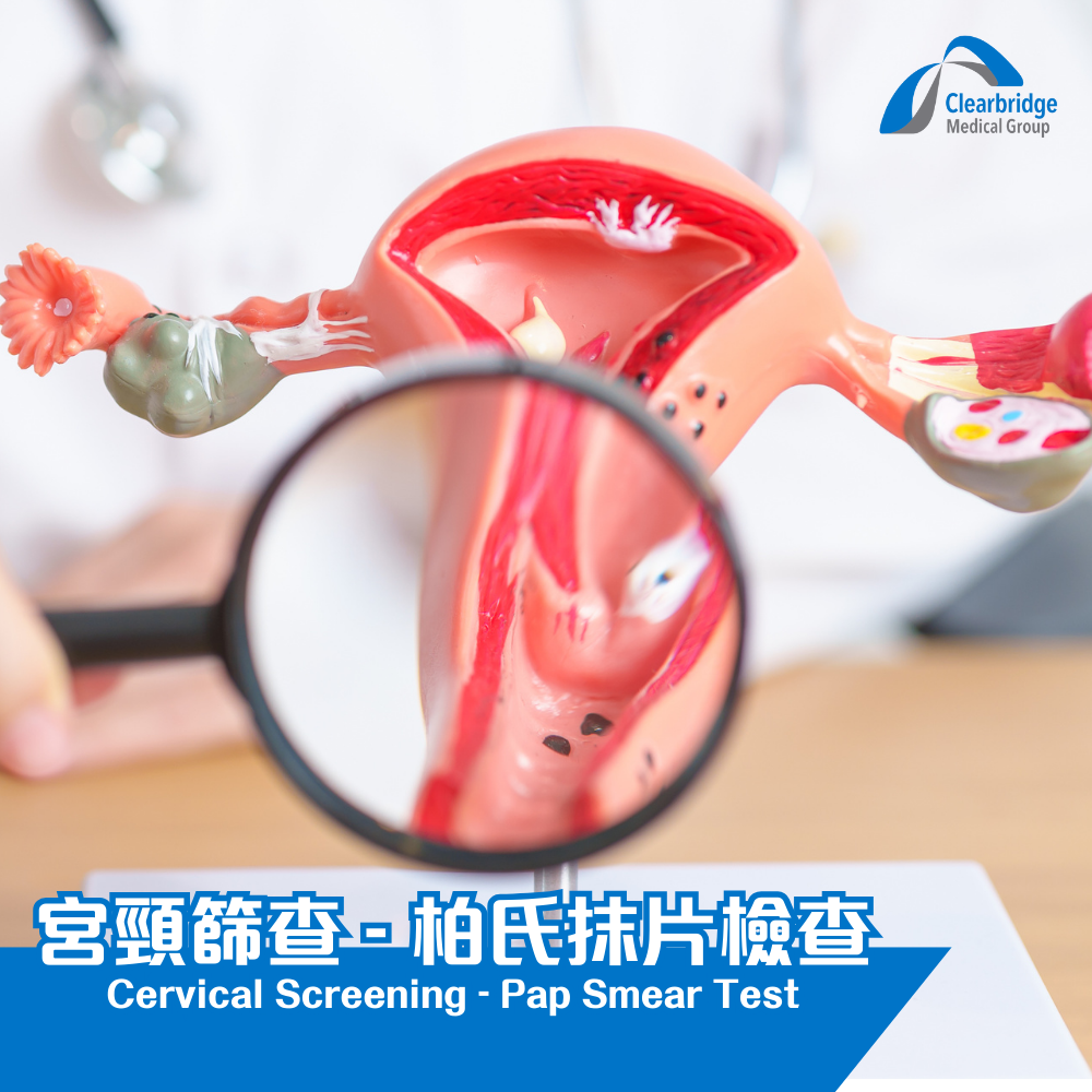 Cervical Screening - Pap Smear Test